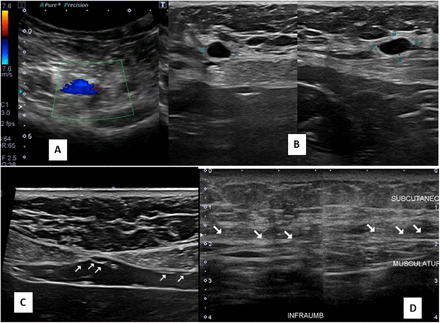 FIGURE 4