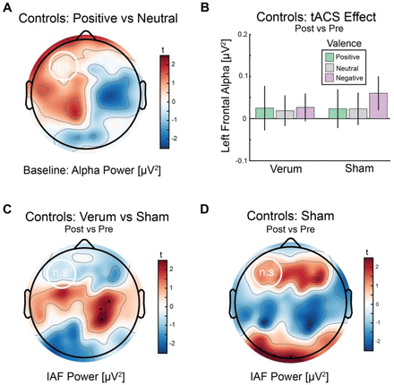 Conducting double-blind placebo-controlled clinical trials of transcranial  alternating current stimulation (tACS)