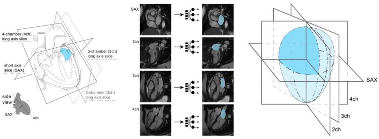 Deep Learning Of Left Atrial Structure And Function Provides Link To Atrial Fibrillation Risk Medrxiv