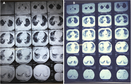 Figure 2: