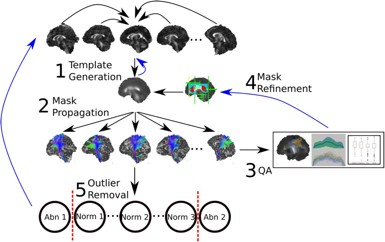 Distribution of intersubject variability in the masked