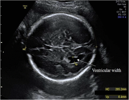 Figure 1: