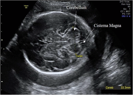 Figure 2: