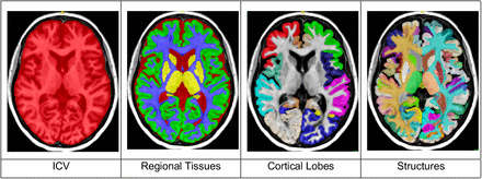 Figure 1: