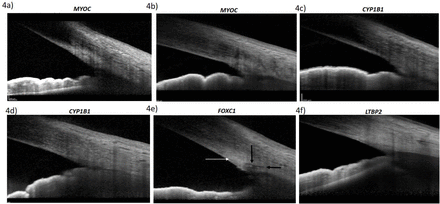 Fig 4: