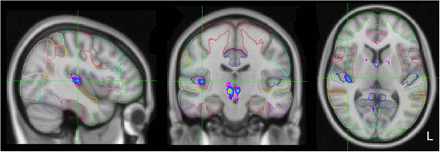 Fig. 9.