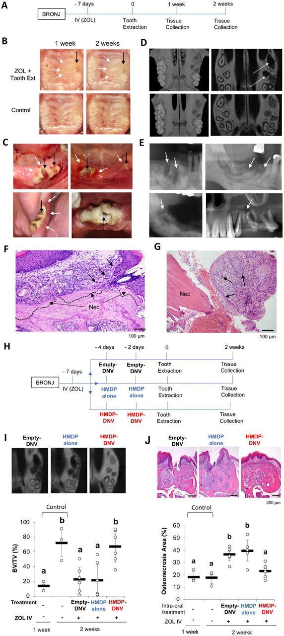 Osteonecrosis development by tooth extraction in zoledronate treated mice  is inhibited by active vitamin D analogues, anti-inflammatory agents or  antibiotics