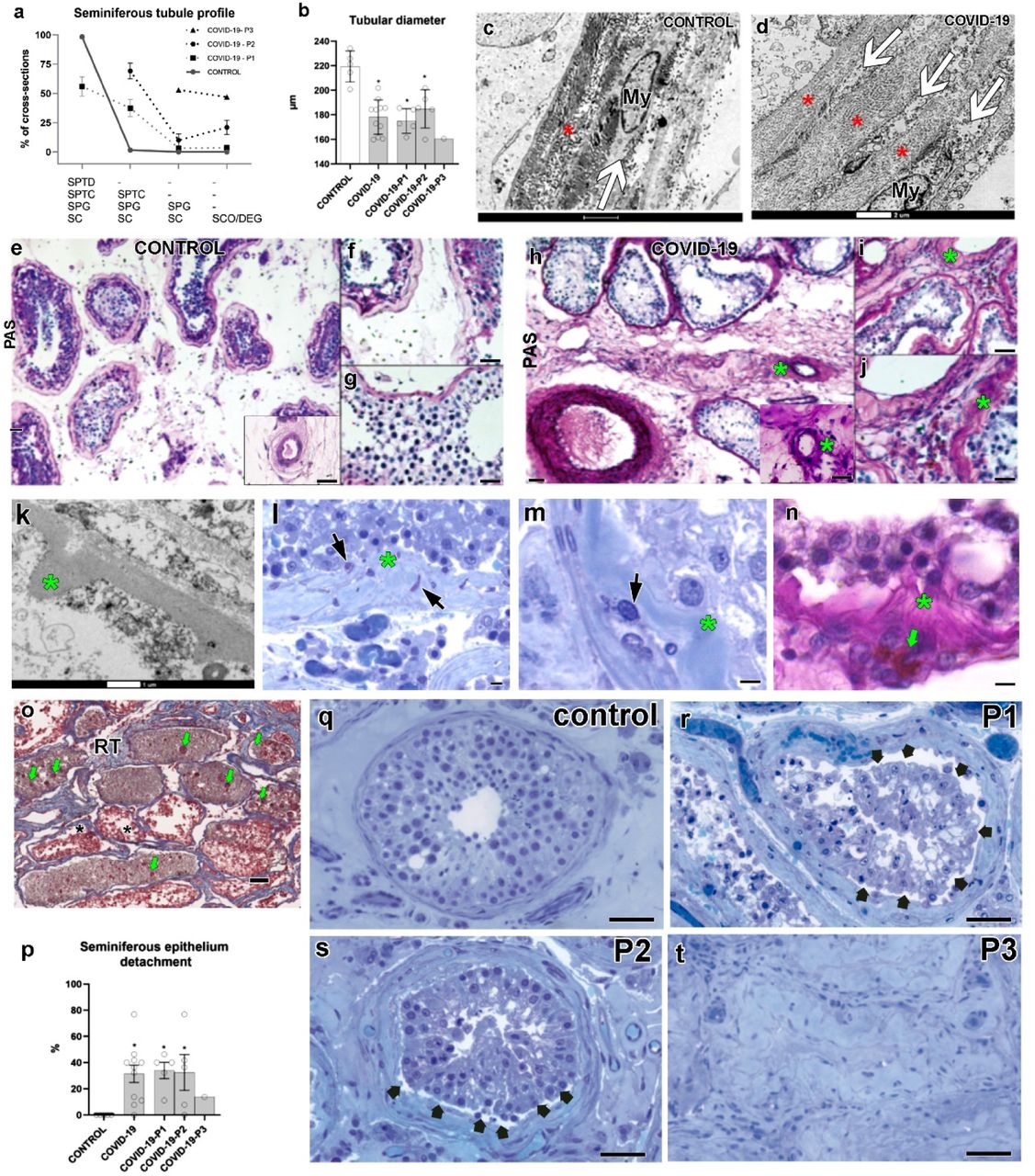 Morphology of Leydig cells in the testes after in vivo MCP-1 treatment.
