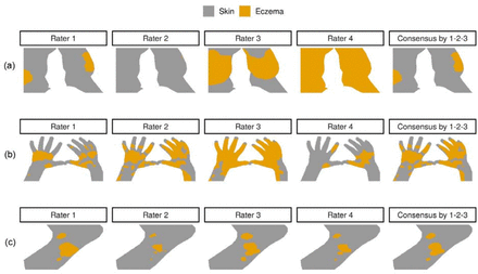 Figure 1: