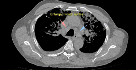 Figure 2: