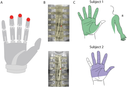 Supplementary Figure 1: