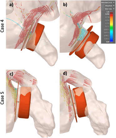 Figure 5: