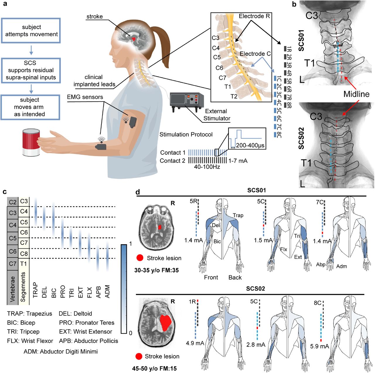 Effects of neuromuscular electrical stimulation and voluntary commands on  the spinal reflex excitability of remote limb muscles