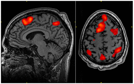 Figure 1: