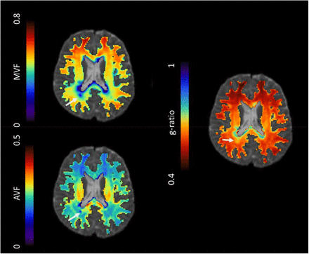 Figure 2: