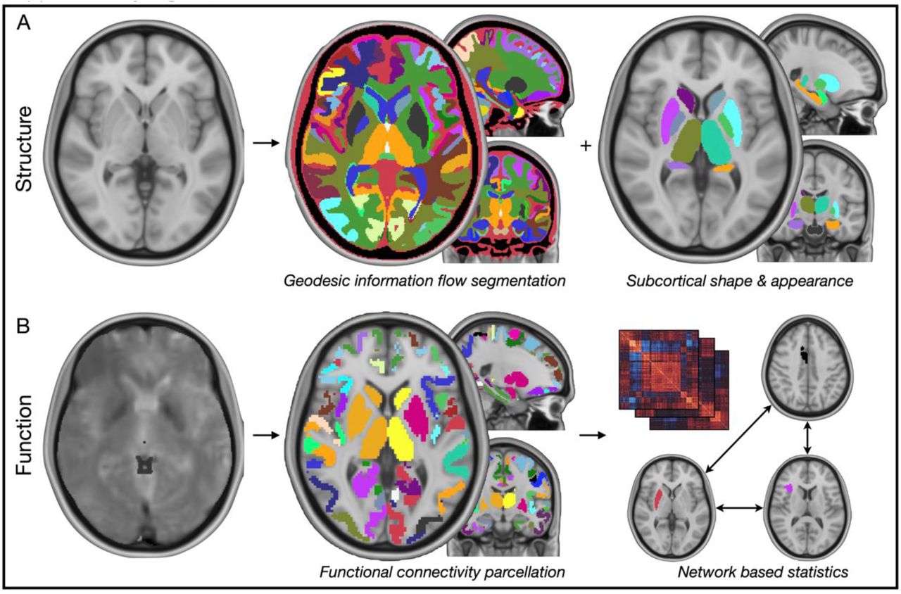 Mild cognitive impairment in retired professional football players with a  history of mild traumatic brain injury: A pilot investigation. – Sports  Neuropsychology Society