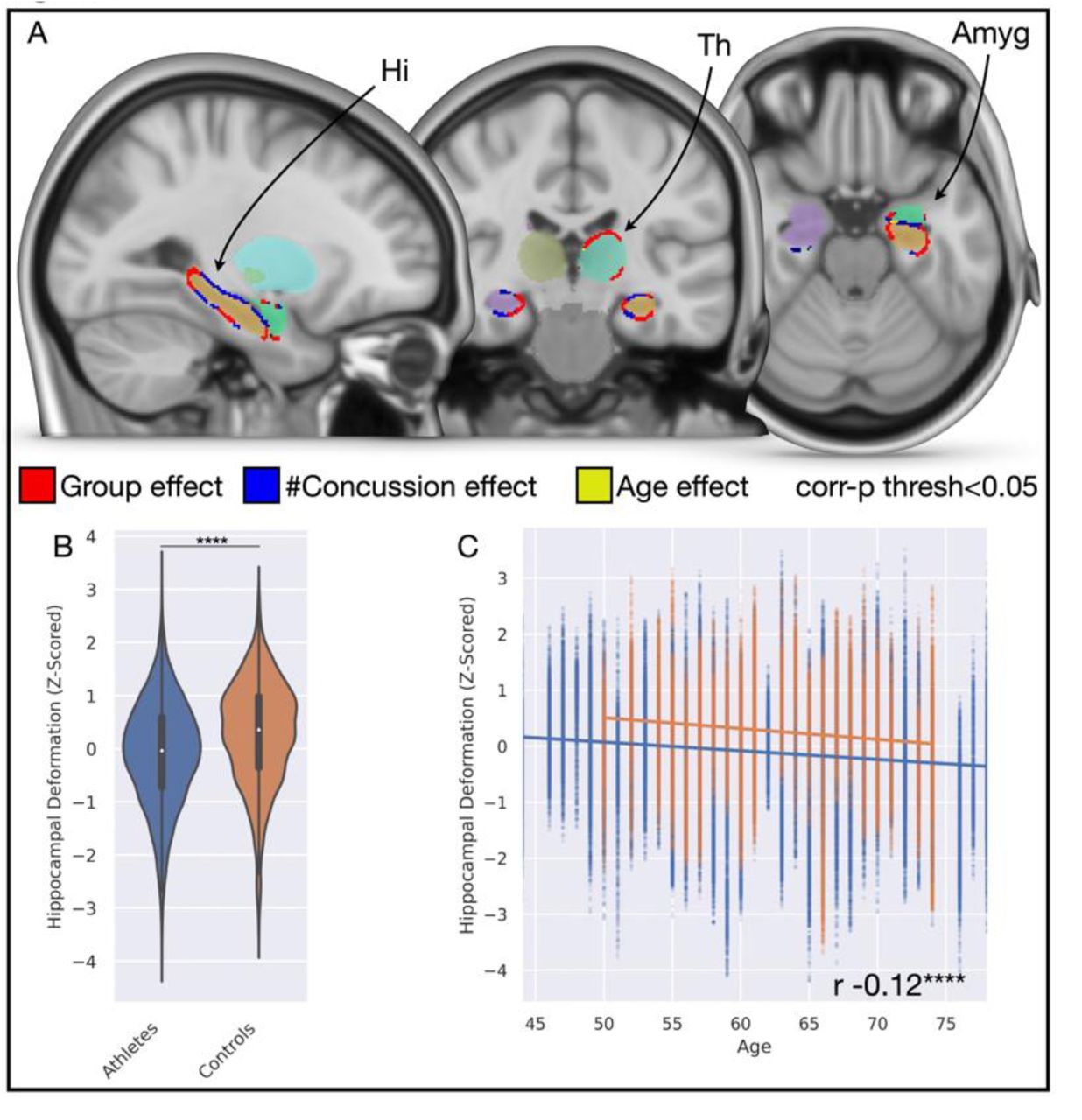 Mild cognitive impairment in retired professional football players with a  history of mild traumatic brain injury: A pilot investigation. – Sports  Neuropsychology Society