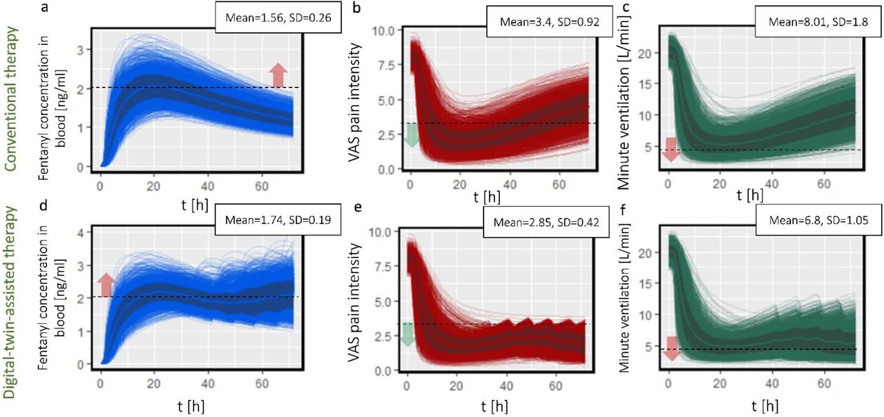 Predicting transdermal fentanyl delivery using mechanistic simulations for  tailored therapy