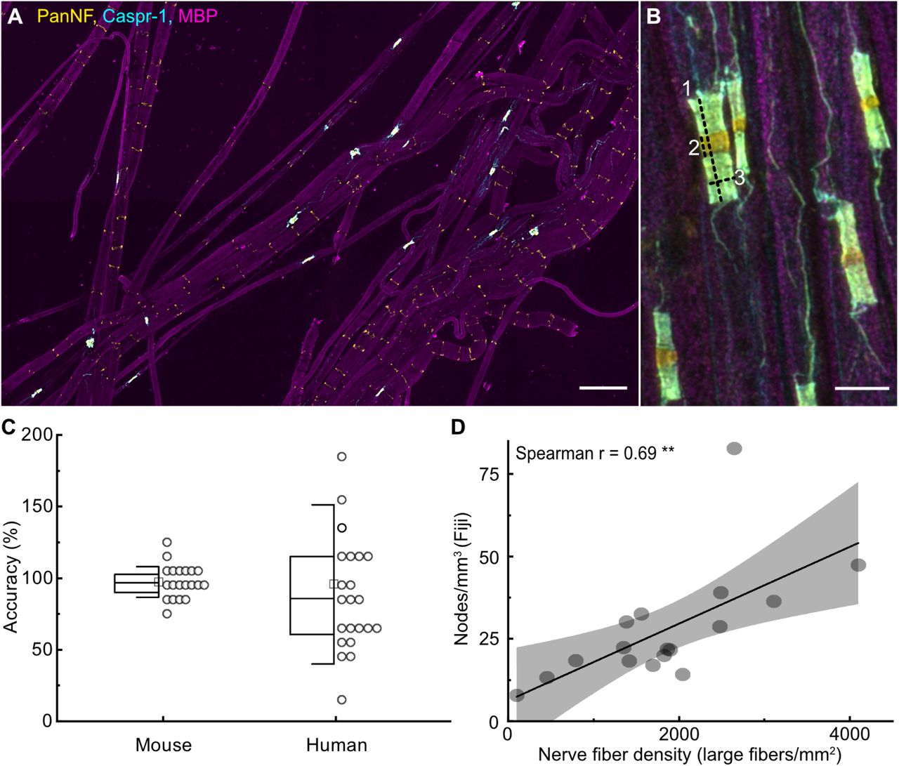 teased myelinated nerve fiber slide