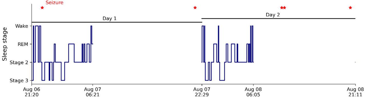 Frontiers  Seizure Diaries and Forecasting With Wearables: Epilepsy  Monitoring Outside the Clinic