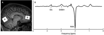 Figure 1: