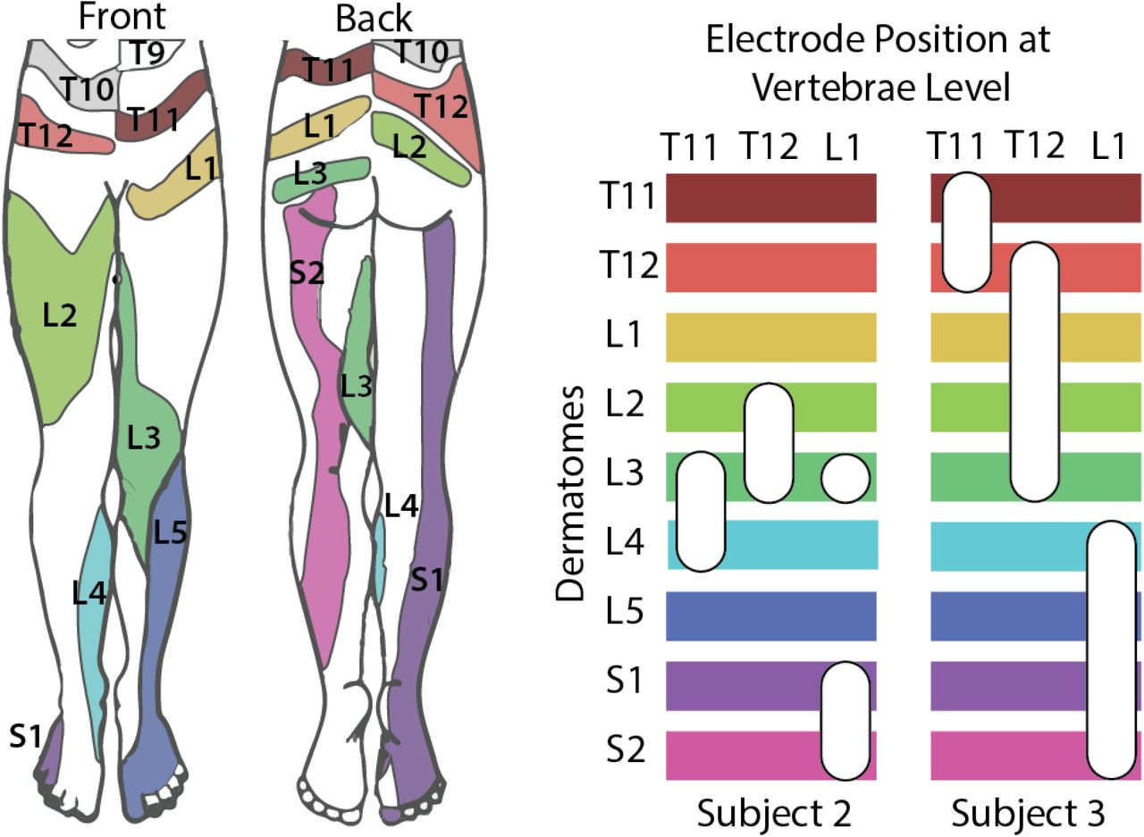 Next-gen Device Could Relieve Phantom Limb Pain