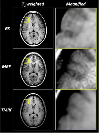 Figure 4: