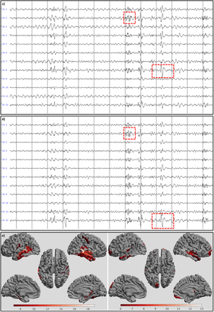 Figure 4: