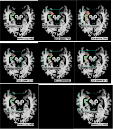 Figure 2: