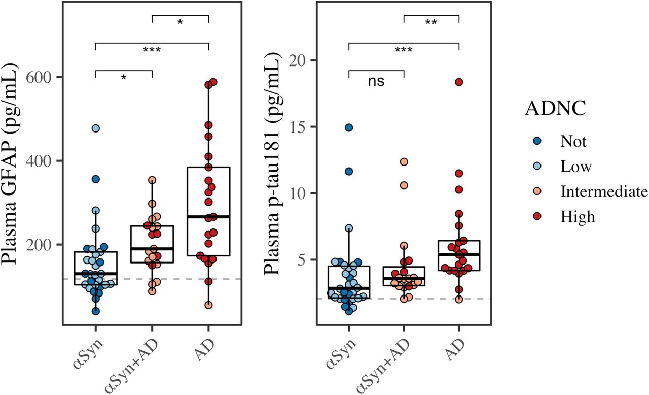 Early identification of Alzheimer's disease in mouse models