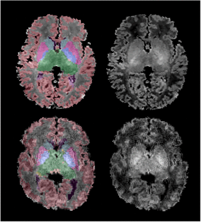 Figure 2: