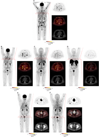 Supplementary Figure 1: