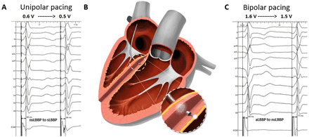 Figure 1: