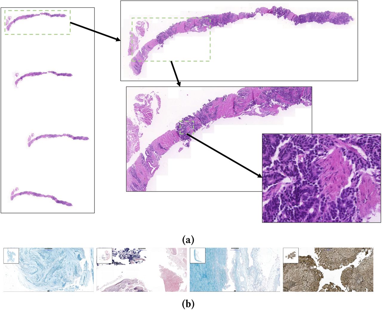 Privacy Risks of Whole-Slide Image Sharing in Digital Pathology