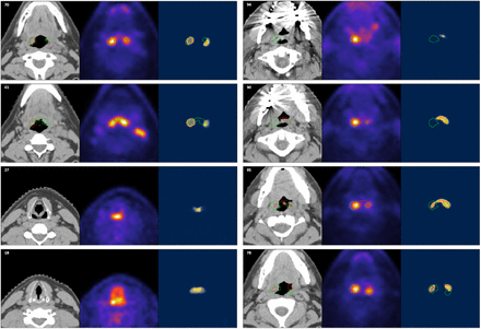 Figure B2: