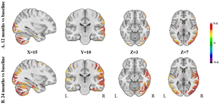 Fig 2.