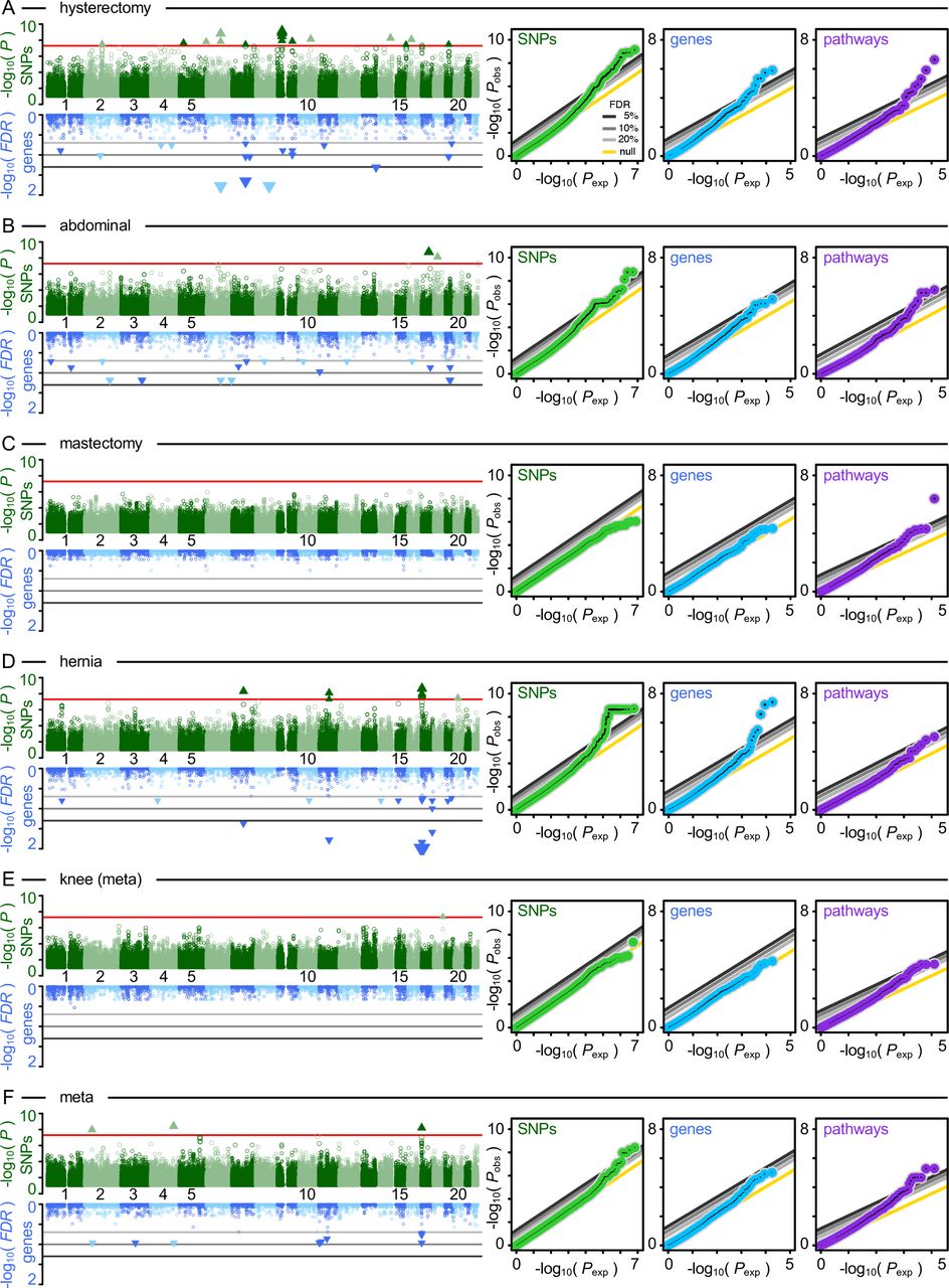 Genome-wide association study of nociceptive musculoskeletal pain treatment  response in UK Biobank