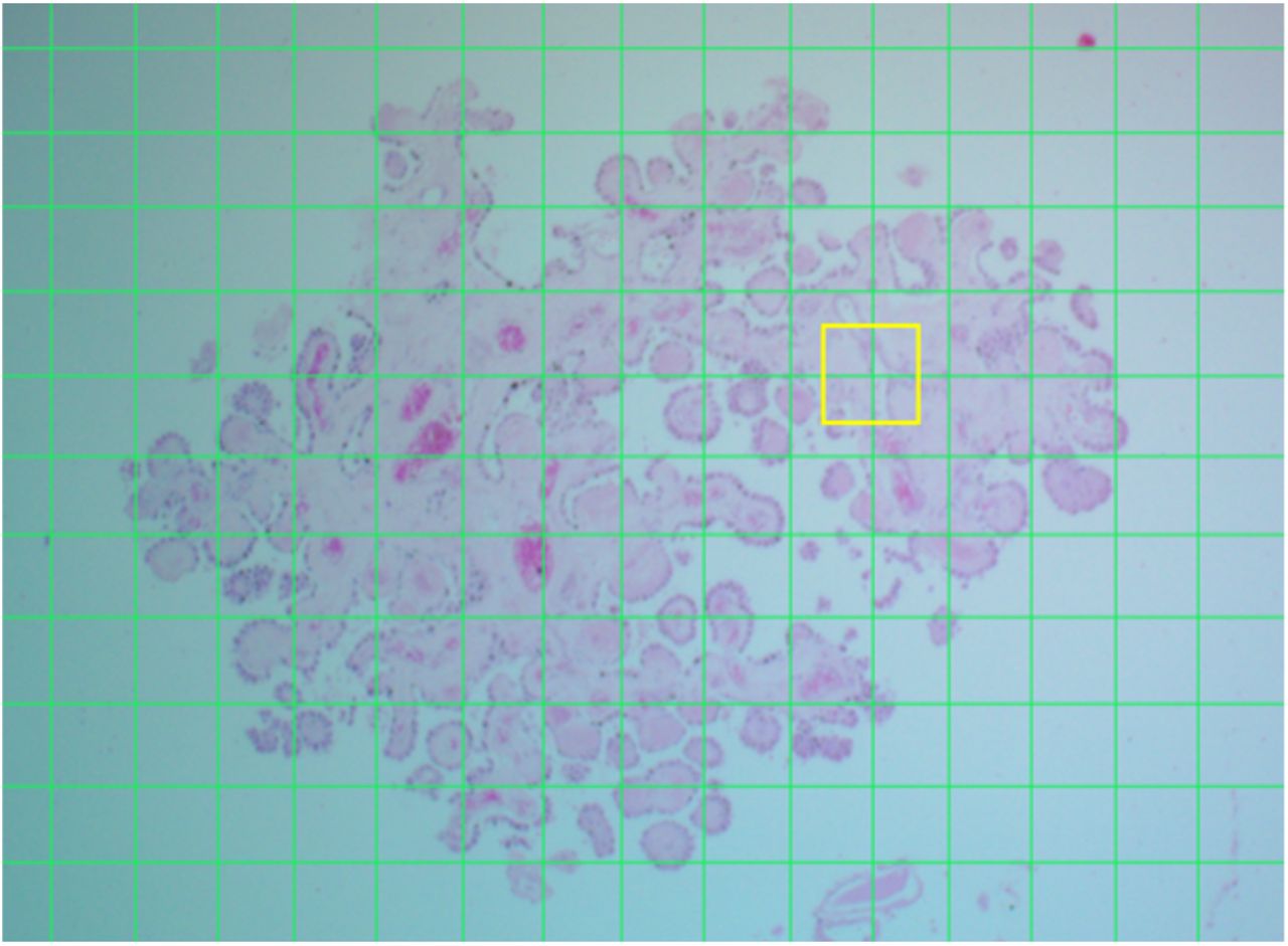 Histological examination of choroid plexus epithelia changes in  schizophrenia | medRxiv