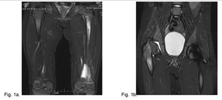 Fig. 1a.