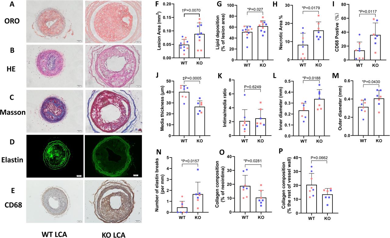 Accelerated atherosclerosis development in C57Bl6 mice by overexpressing  AAV-mediated PCSK9 and partial carotid ligation - Laboratory Investigation