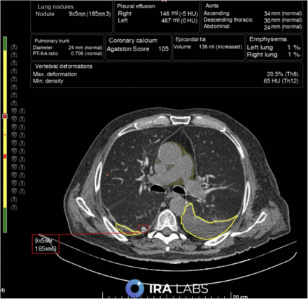 Figure 6.