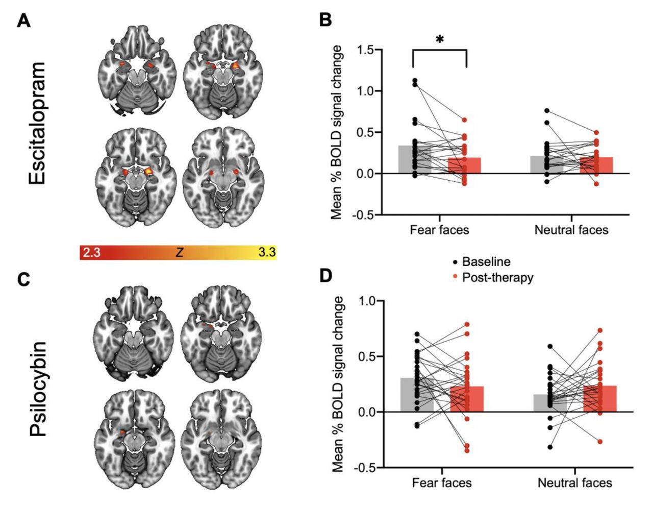 Can psychedelic drugs 'reconnect' depressed patients with their emotions?, Imperial News