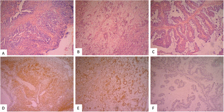 Figure 2: