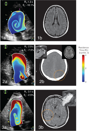 FIGURE 3: