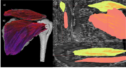 Fig 2.