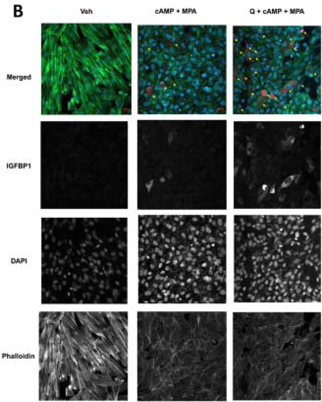 Quercetin enhances decidualization through AKT-ERK-p53 signaling and  supports a role for senescence in endometriosis | medRxiv