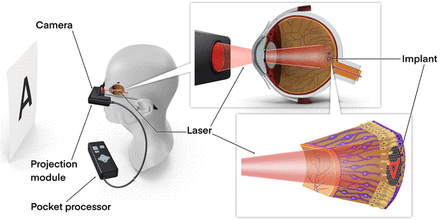 Figure 2: