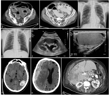 Figure 2: