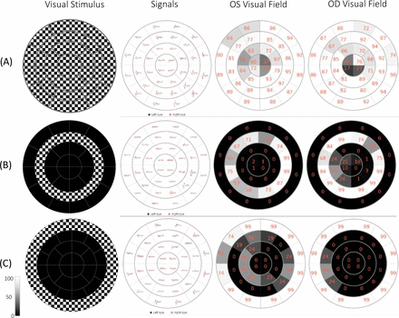 Figure 11.