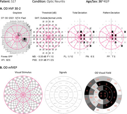 Figure 13.